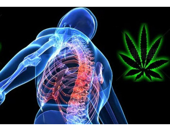 Национальный опыт лечения растительным CBD заболеваний, связанных с опорно-двигательной системой